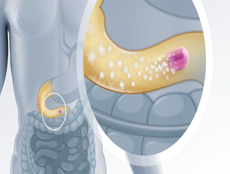 Evonik launches oral drug delivery technology  