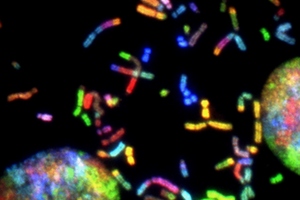 Expansion of proprietary AAV gene therapy product line