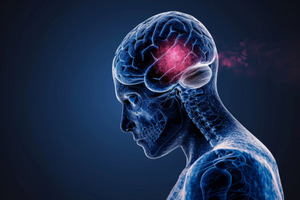 FDA approves Telix’s first FET-PET imaging drug for glioma