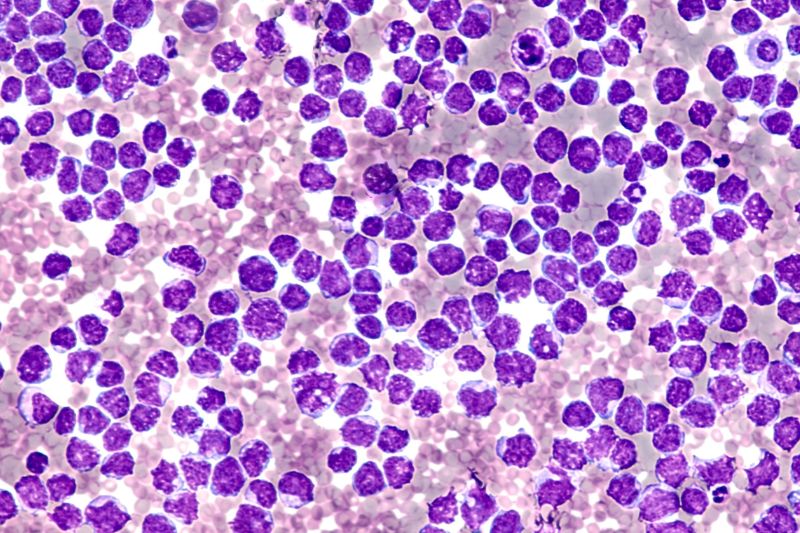 FDA grants Breakthrough Therapy designation to BeOne Medicines' sonrotoclax