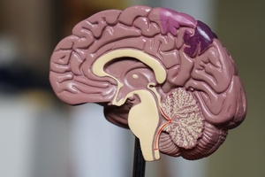 FDA grants landmark approval for Alzheimer’s treatment