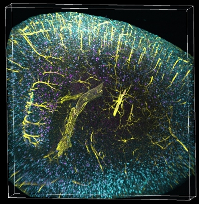 Fisher Center scientists visualise brain defects that cause Alzheimer's disease

