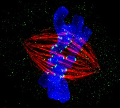 GE Healthcare names Cell Imaging Competition winners