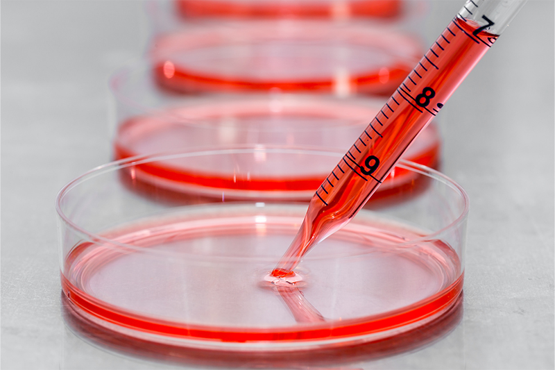 Gentle and rapid detachment of even delicate adherent cells
