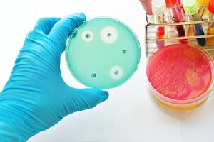 Global CDMO joins antimicrobial resistance alliance