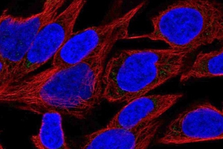 Horizon signs license agreement with Glenmark for CHO cell line
