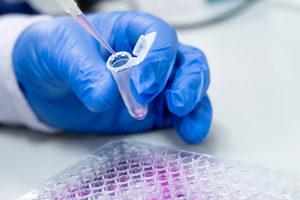 How microfluidic diffusional sizing can enhance your protein assays
