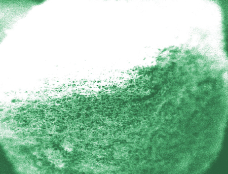 Injectable ‘smart sponge’ helps control release of insulin