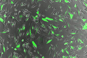 Johns Hopkins develops gene therapy technique for cancer