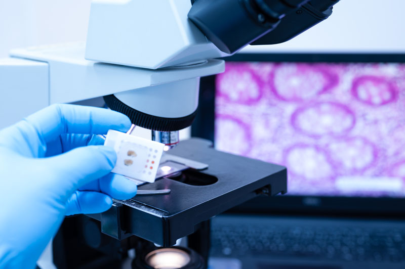 Leica Biosystems expands leading digital pathology portfolio for the US with multiple launches at Pathology Visions 2025