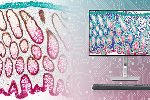 Leica Biosystems launches ChromoPlex III Detection System
