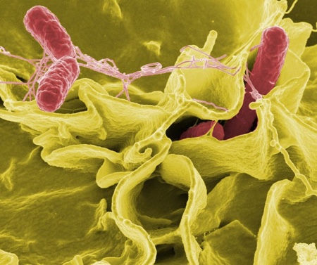 Light-activated nanoparticles prove effective against antibiotic-resistant 'superbugs'