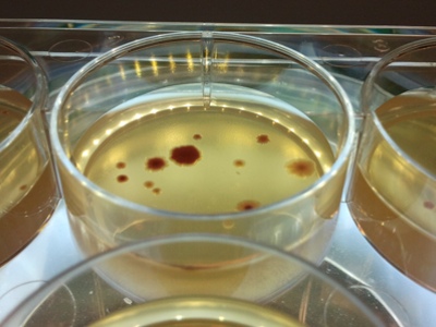 \'Lonely’ bacteria increase risk of antibiotic resistance 