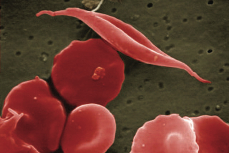 Lonza to manufacture Vertex's CRISPR/Cas9 cell therapy, Casgevy