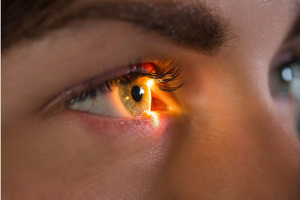 Lupin completes acquisition of VISUfarma from GHO to expand ophthalmology portfolio