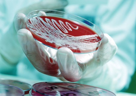 Maintaining control of bioburden