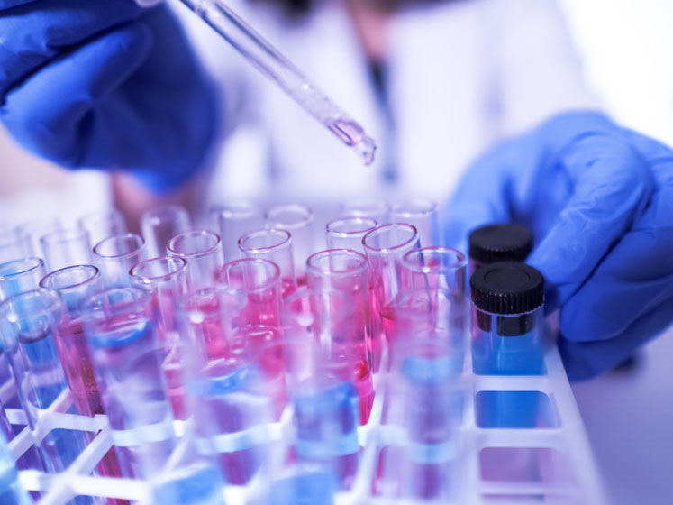Measuring the mood in the laboratory sector: materials bottlenecks and staff shortages