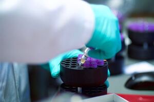 Metabolic biomarker profiling agreement for Oxford University
