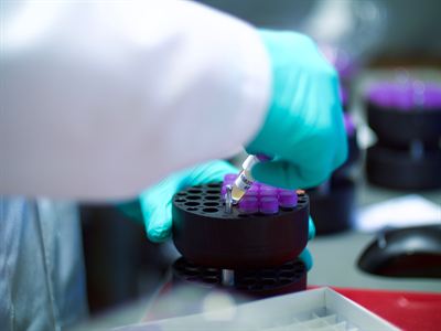 Metabolic biomarker profiling agreement for Oxford University