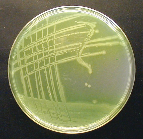 Microbial testing: Harmonisation and its effects