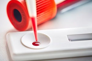 Mologic completes new ultra-sensitive rapid diagnostic test