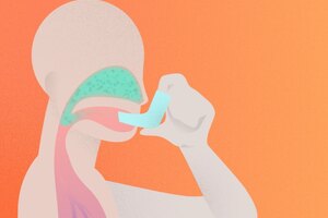 Nemera: RetroNose enhances therapeutic efficacy of nasal treatments