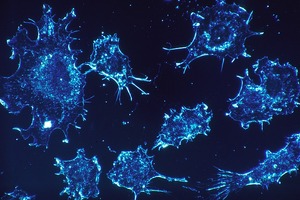 New research highlights potential of iOnctura strategy combining autotaxin and TGF-β inhibitors in cancer