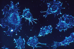 Non-small cell lung cancer market projected to be worth $14.6 billion by 2024