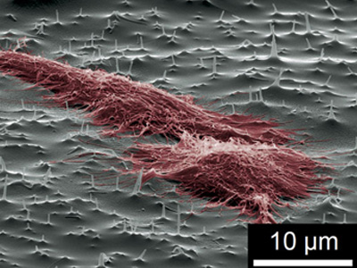 Norwegian researchers develop nano-needles 
