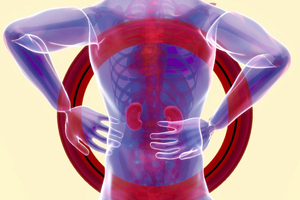 Novartis' Fabhalta bags FDA accelerated approval for Berger's disease