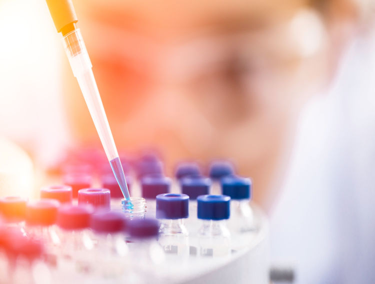 Novasep invests to expand API production in France
