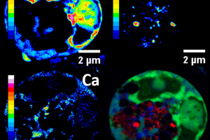 Organo-metal compound kills cancer cells from inside
