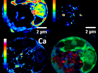 Organo-metal compound kills cancer cells from inside
