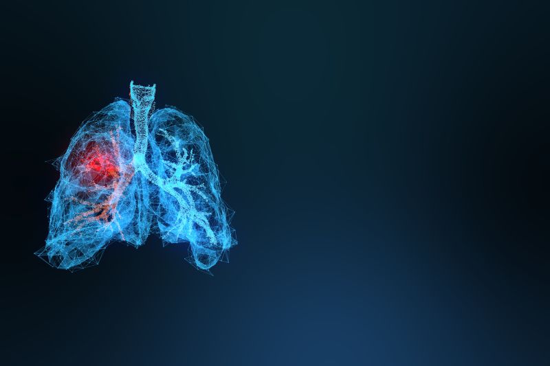 OSE Immunotherapeutics gets positive IDMC recommendation to continue Phase III trial of Tedopi for lung cancer