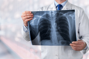 OSE Immunotherapeutics receives positive IDMC review for Phase III ARTEMIA trial
