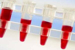 Parsortix method: new applications for circulating tumour cells