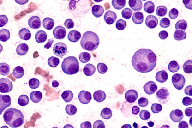 Pepaxti gains positive CHMP opinion for third-line multiple myeloma treatment
