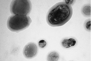 Peptide vesicle designed to improve delivery of drugs 