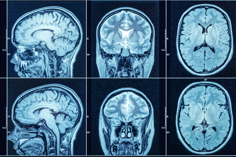 PhoreMost announces PMC-001 as lead oncology programme