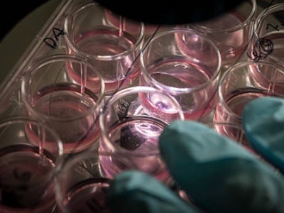 Plasticell and GSK collaborate to produce hematopoietic cells