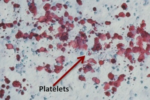 Plasticell wins military contract to develop regenerative medicines