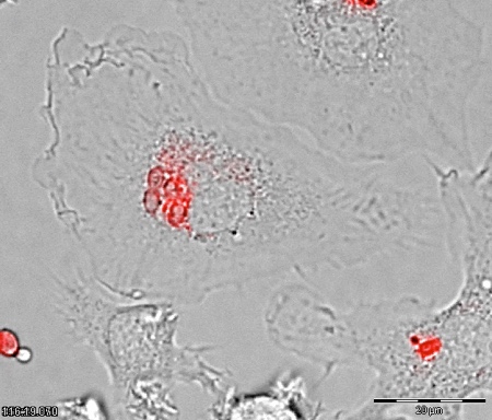 Potential new treatment to combat lethal fungal infections