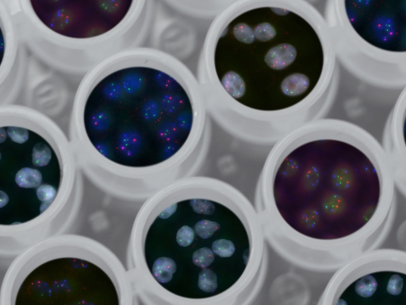 Proprietary AAV gene therapy product line to launch