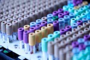 Recipharm signs deal for vaccine filling at Kayserberg