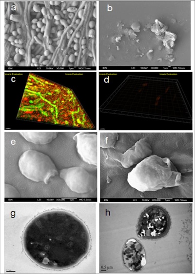 Researchers convert recycled plastics into disease-fighting nanofibres