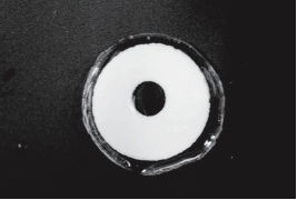 Researchers develop drug-dispensing contact lens