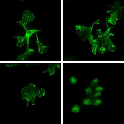 Researchers speed up creation of perfect drug combinations