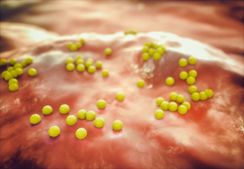 Researchers uncover camouflage strategy of multi-resistant bacteria 

