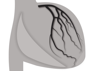 Room for progress in dyslipidemia, say GlobalData
