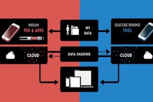 Sanofi and Abbott partner to integrate glucose sensing and insulin delivery